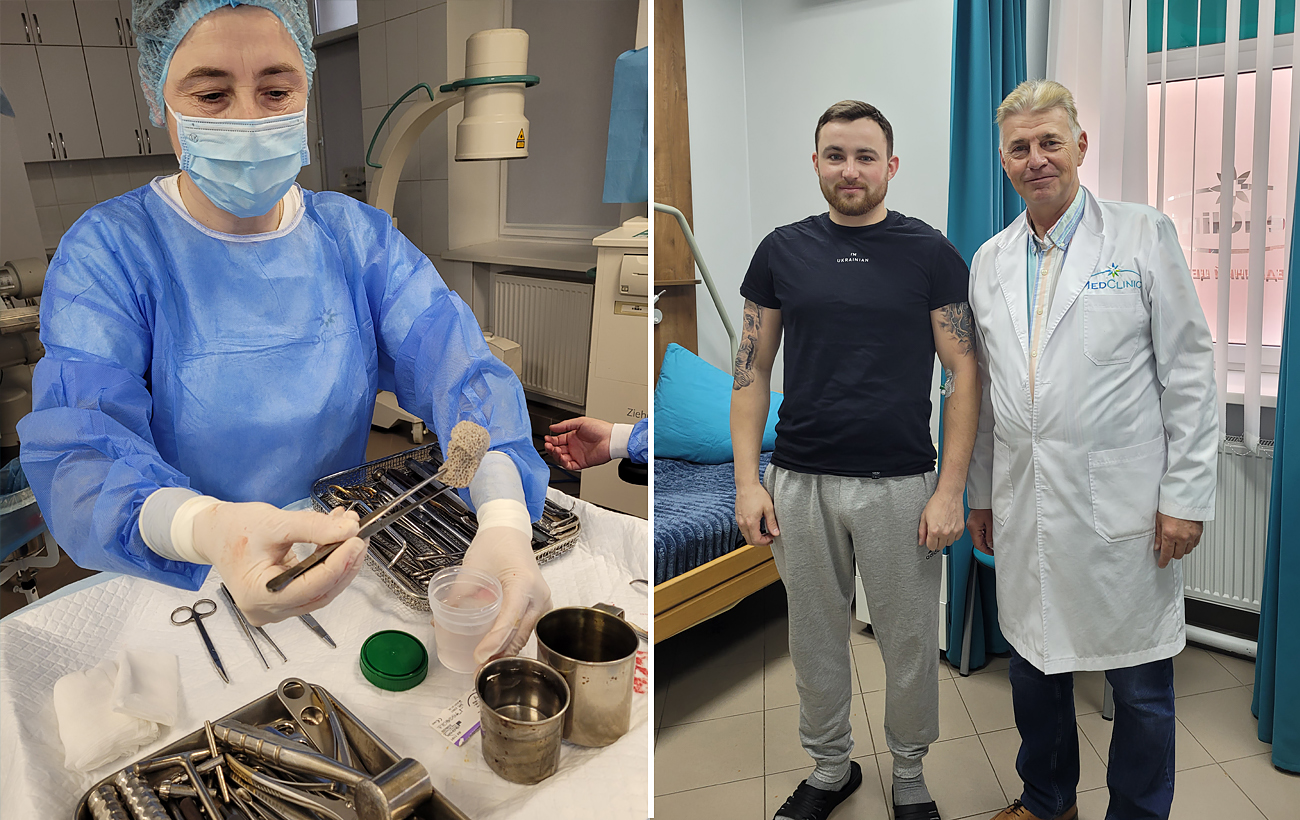 "Ходитимуть своєю ногою, а не протезом". Як в Україні відновлюють кістки військовим